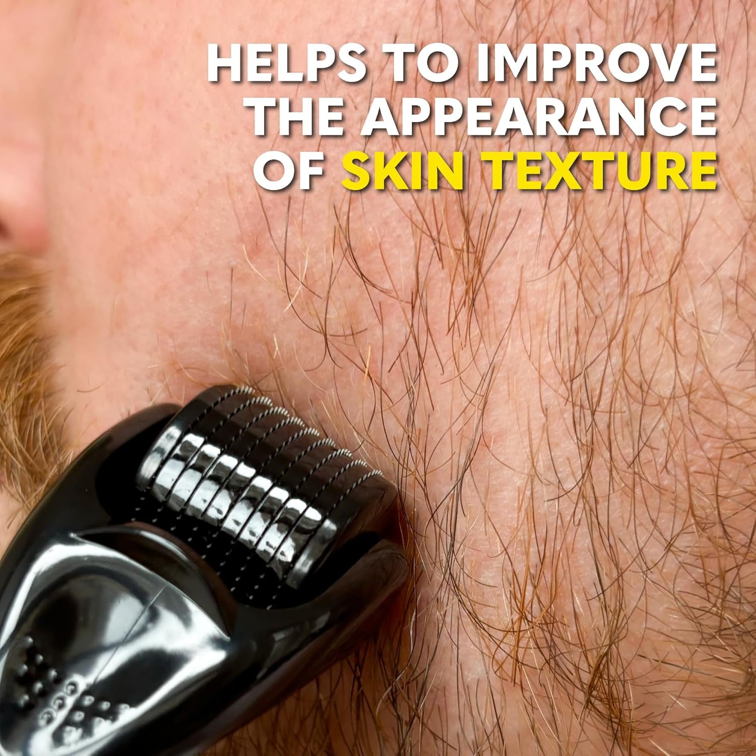 Beard Club Derma Roller for Face, Body and Scalp - Microneedling Roller for Men and Women with 540 Titanium Microneedles - Beard Roller for Hair & Beard - PHamily Hair Care