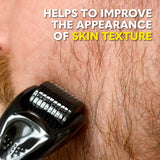 Beard Club Derma Roller for Face, Body and Scalp - Microneedling Roller for Men and Women with 540 Titanium Microneedles - Beard Roller for Hair & Beard - PHamily Hair Care