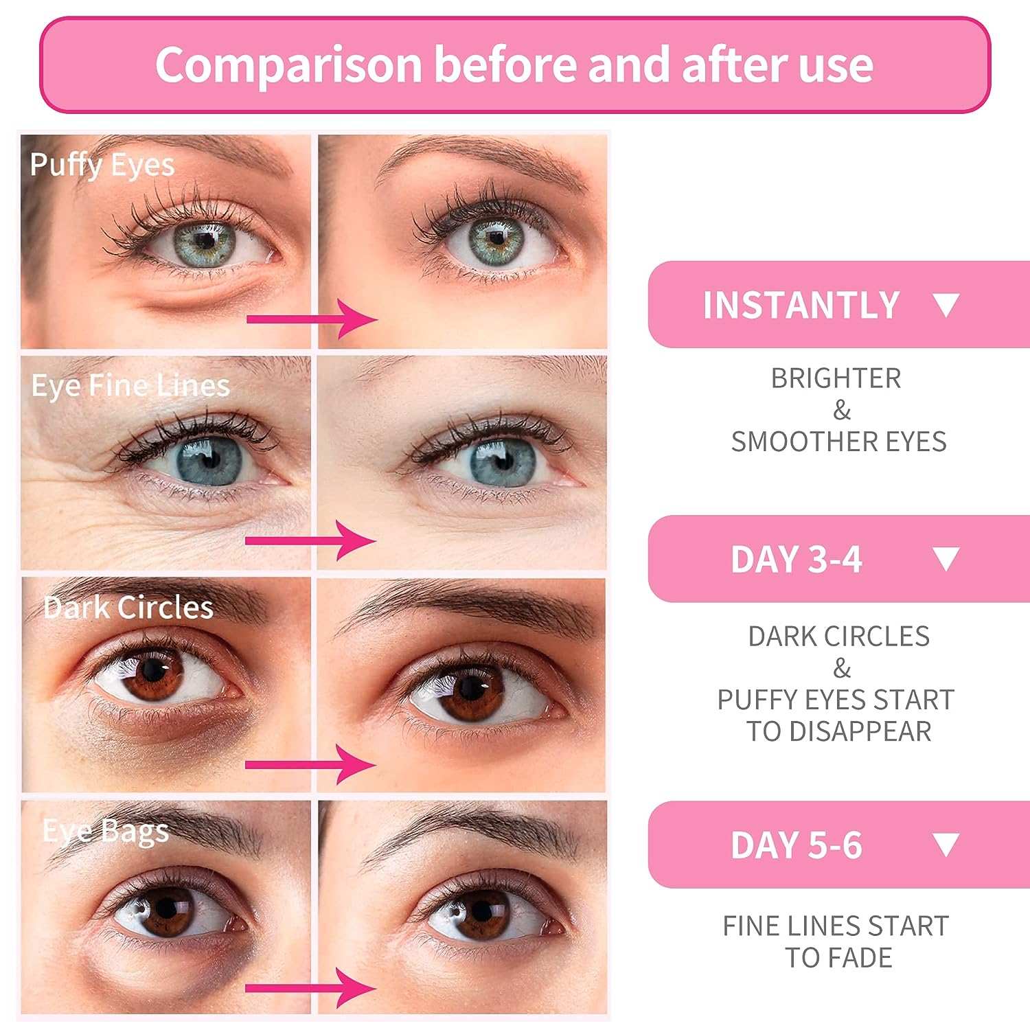 60 Pcs Rose Eye Mask for Dark Circles | Hydrating & Refreshing